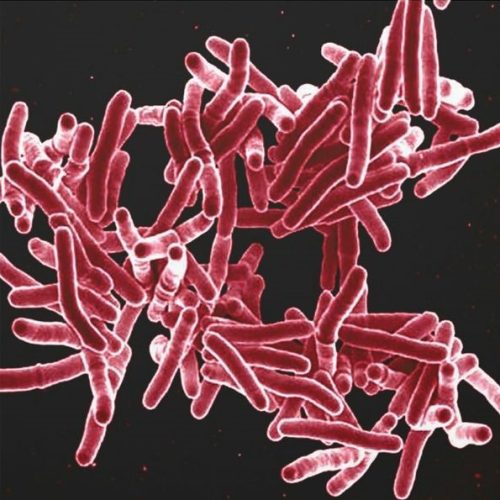 Mycobacterium tuberculosis